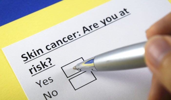 Back to Basics: Understanding the World’s Most Common Cancer